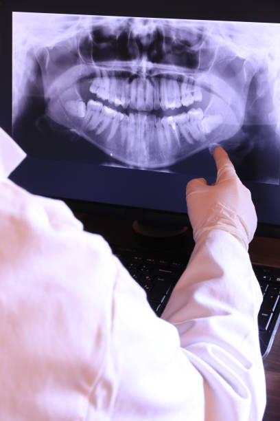 Best Urgent Care for Lost Fillings or Crowns in Silver Spring, MD