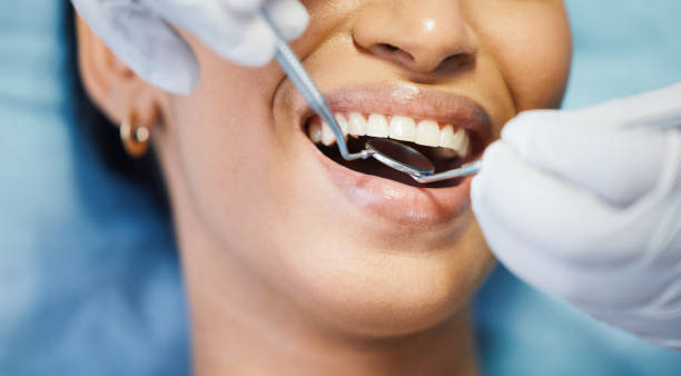 Best Emergency Dental Care for Broken or Chipped Teeth in Silver Spring, MD